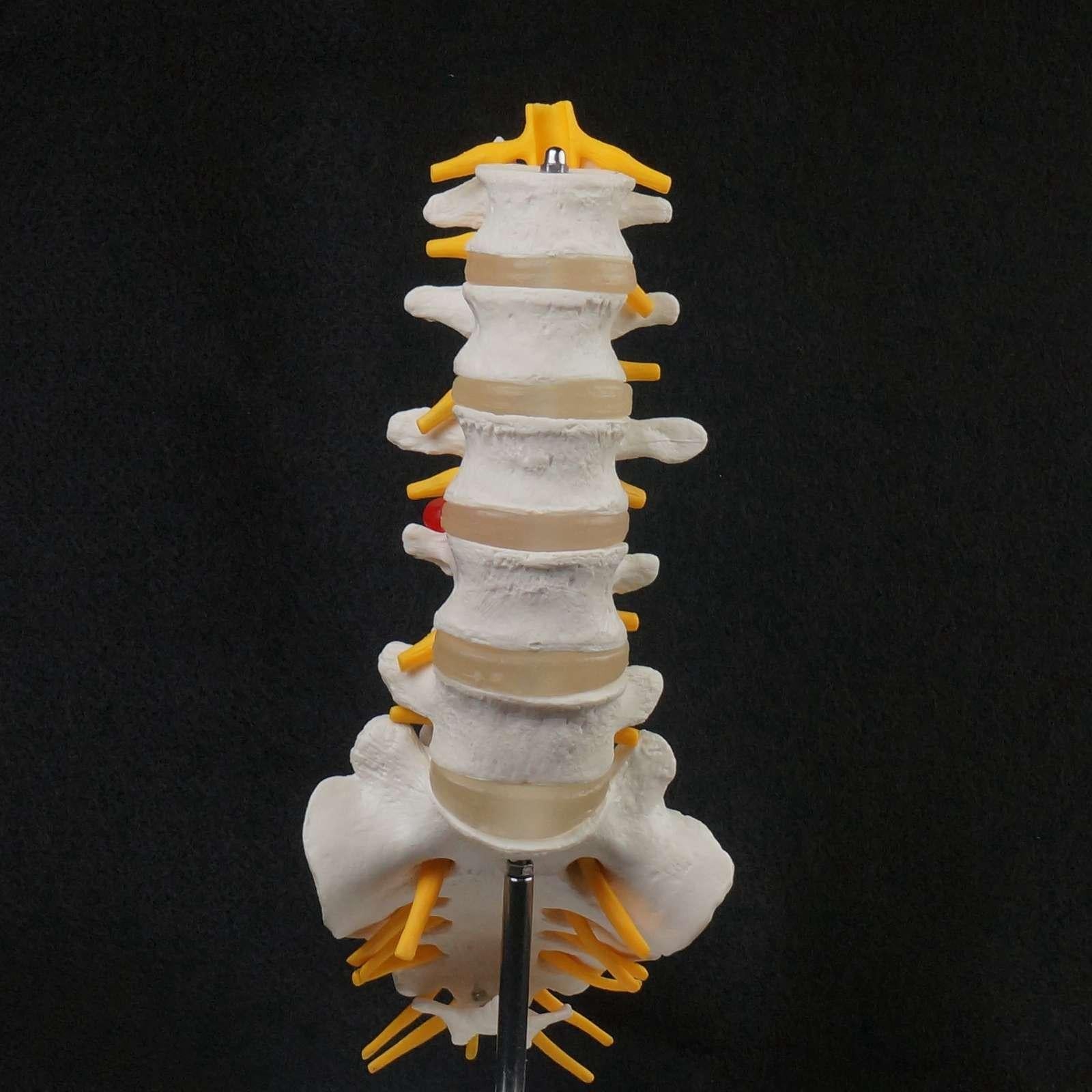 Human Lumbar Spine Caudal Vertebra Structure Intervertebral Disc Joint Model - KiwisLove