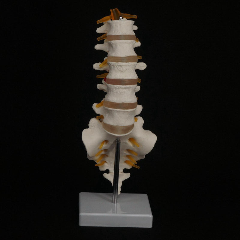 Human Lumbar Spine with Caudal Vertebra Structure Intervertebral Disc Model - KiwisLove