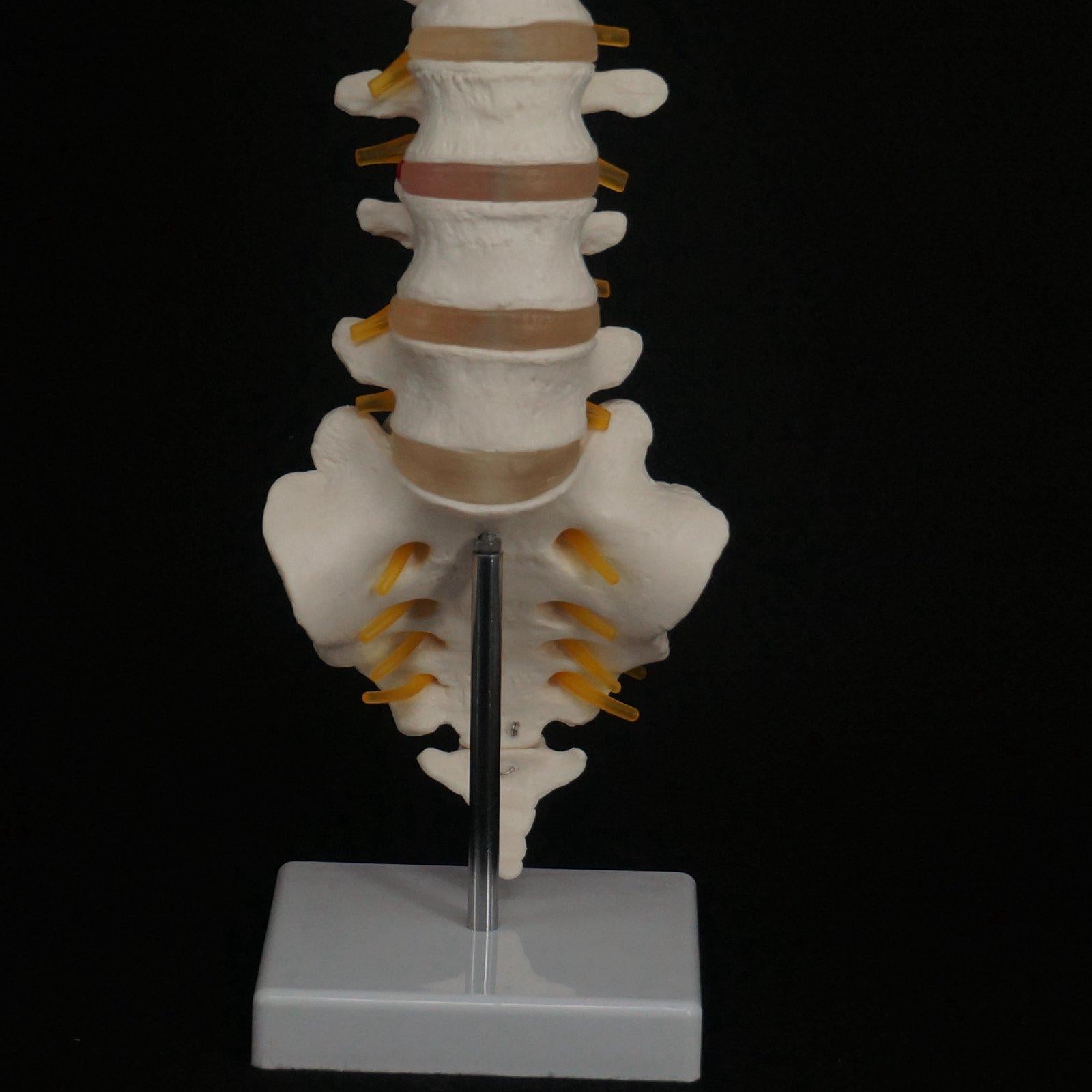Human Lumbar Spine with Caudal Vertebra Structure Intervertebral Disc Model - KiwisLove