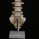 Human Lumbar Spine with Caudal Vertebra Structure Intervertebral Disc Model - KiwisLove
