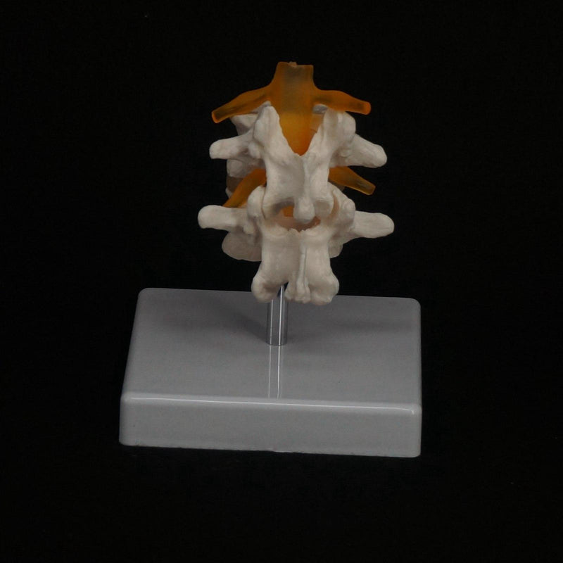 Life Size Two Section Lumbar Spine Skeleton Model with Stand - KiwisLove