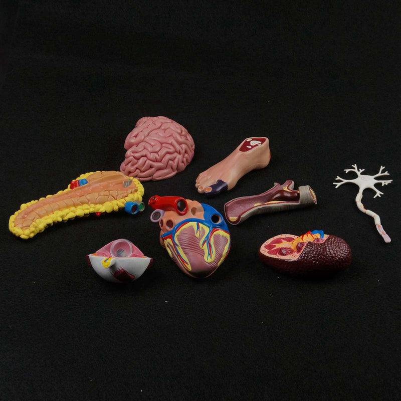 Human Diabetes Model Complications Cerebral Cardiac Pancreas Neuronal Foot - KiwisLove