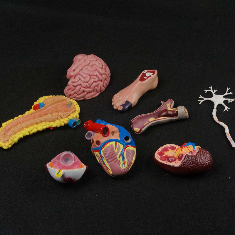 Human Diabetes Model Complications Cerebral Cardiac Pancreas Neuronal Foot - KiwisLove