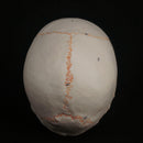 1:1 Numbered Human Head Skull Model Skeleton Medicine Anatomy - KiwisLove